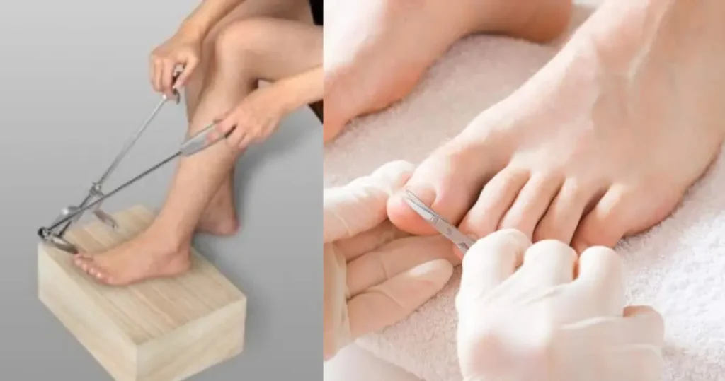 HOW DO YOU CUT TOENAILS IF YOU CAN'T REACH THEM?