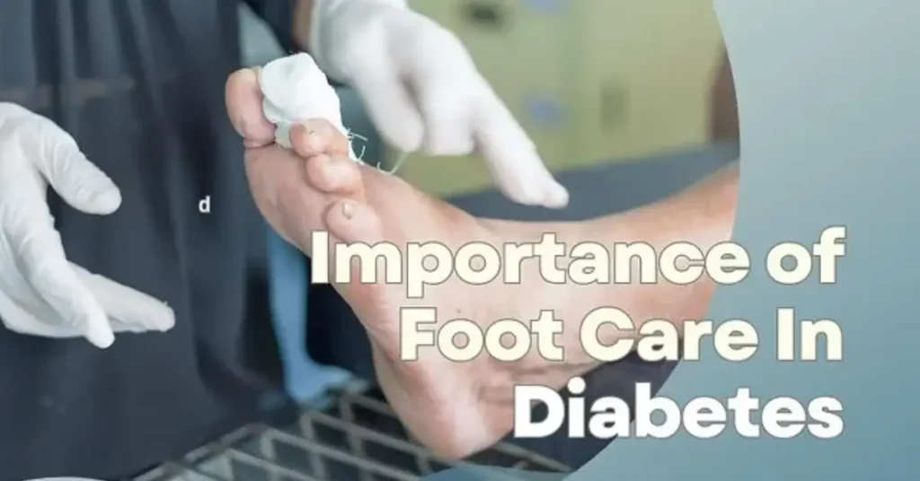  Importance of foot care for diabetics