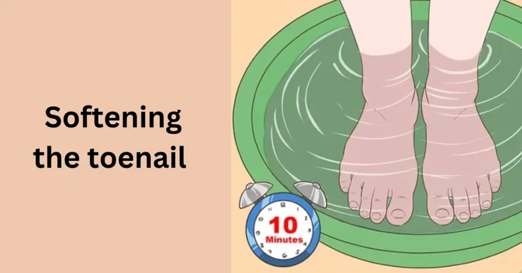  Softening the toenail