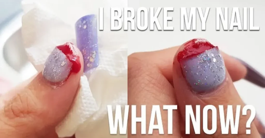 What Do You Do if Your Natural Nail Breaks Under Acrylic?