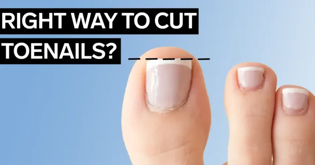 trim your toenails straight across