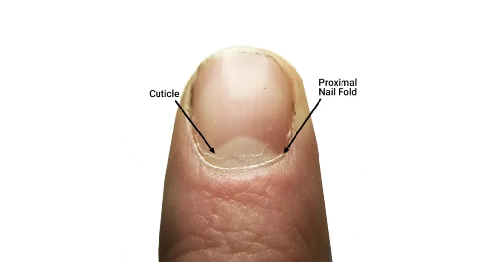 What is the cuticle? 