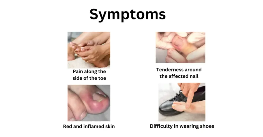 Symptoms