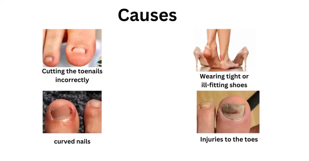 Causes