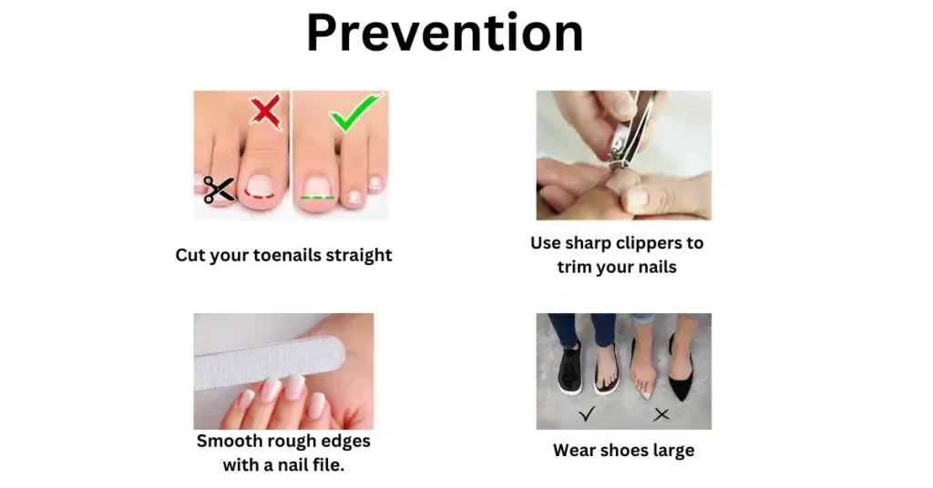 Prevention