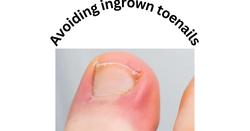 Avoiding ingrown toenails