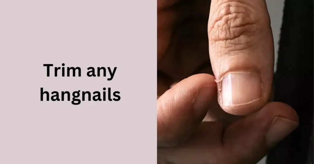 Trim any hangnails